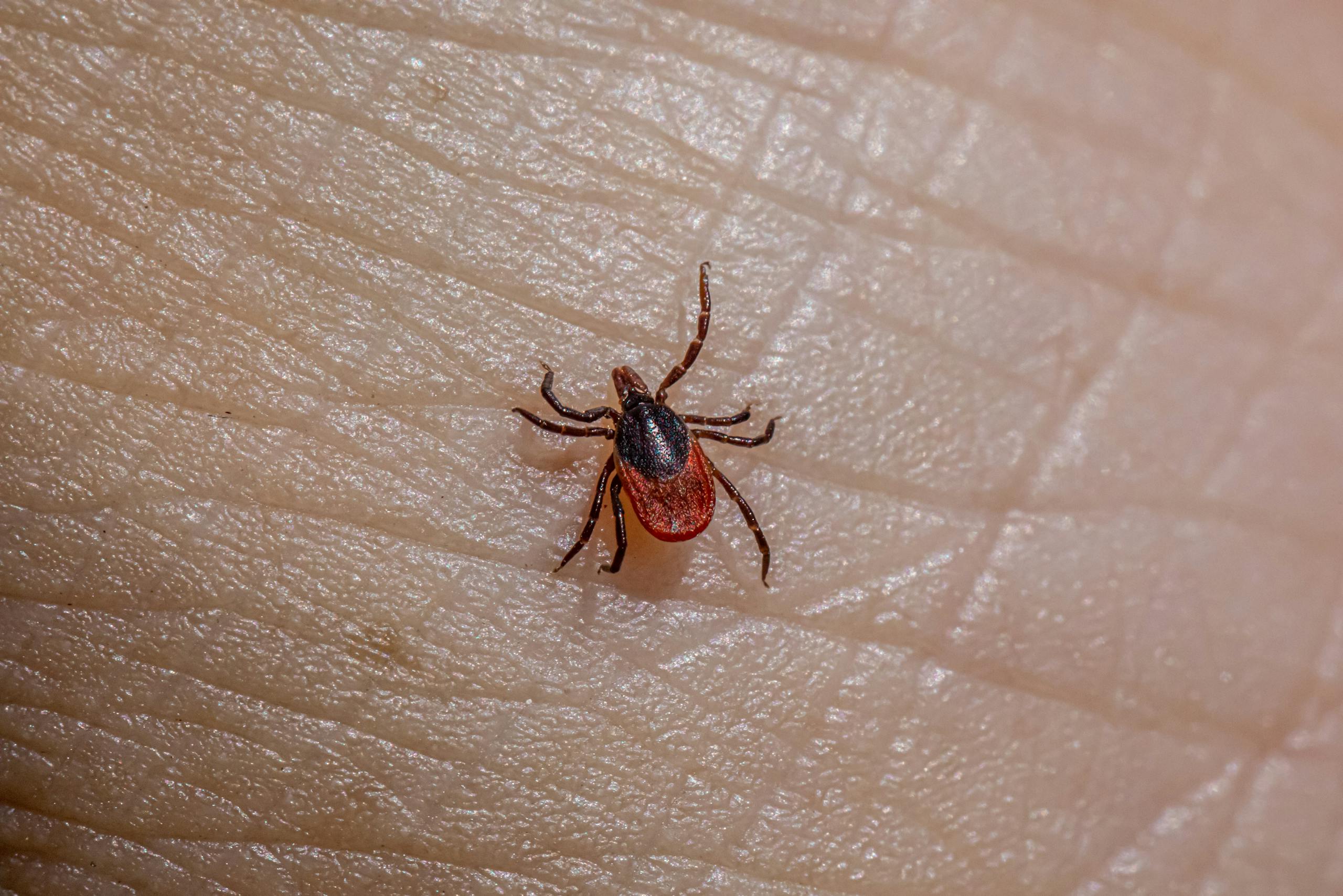 Detailed macro shot of a Castor Bean Tick (Ixodes ricinus) on human skin.